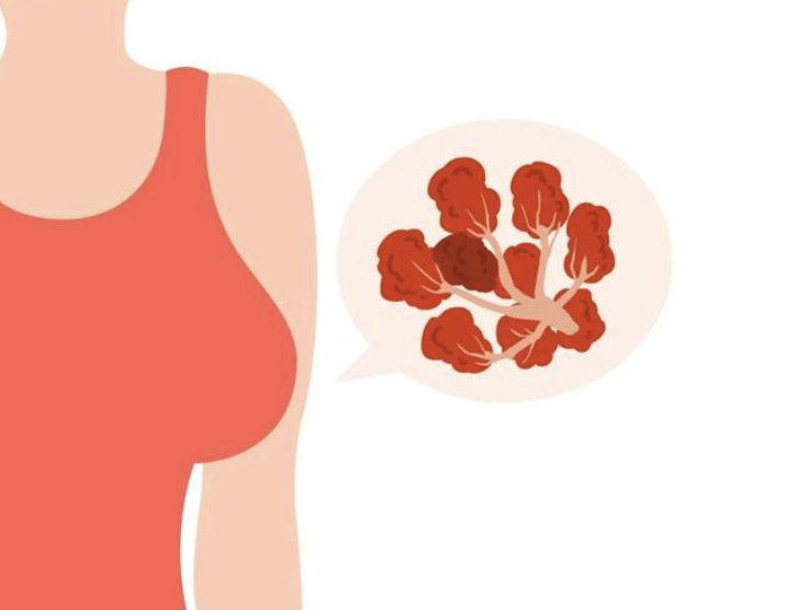 乳腺彩超和乳腺鉬靶有什么區(qū)別？